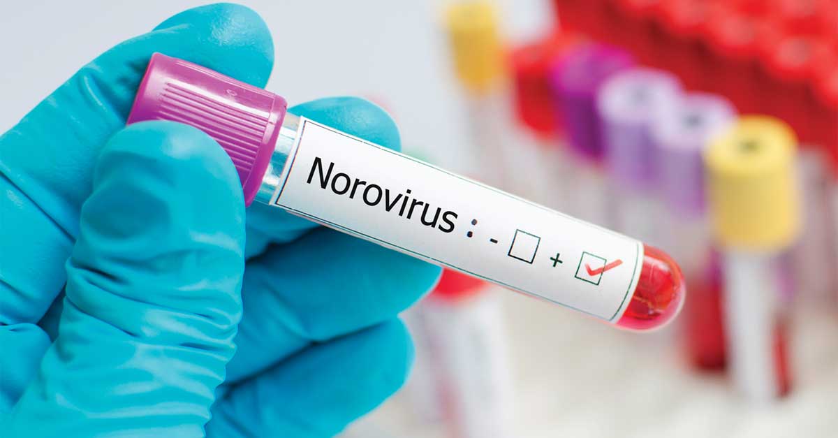 New Test Simplifies Detection of Norovirus