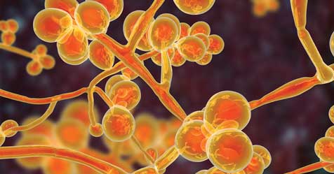 Increase in Drug-Resistant Superbug Linked to Pandemic