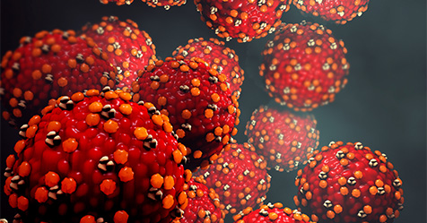 measles