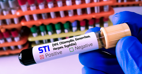 Sexually Transmitted Infection test tube blood sample