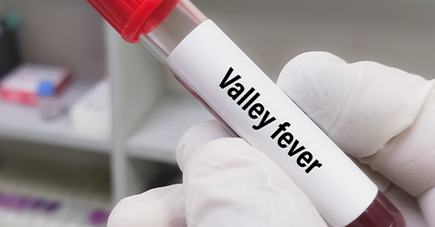 Valley Fever Cases in California Escalate