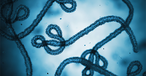 ebola under a microscope